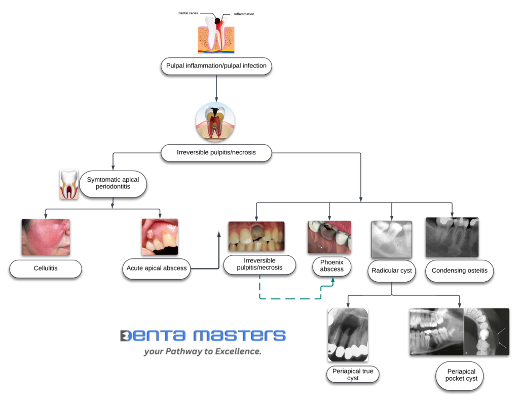 SEQUELAE OF PERIRADICULAR DISEASES