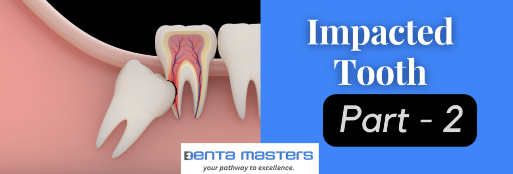 Impacted Wisdom Tooth: How to Prevent Complications (2/5)