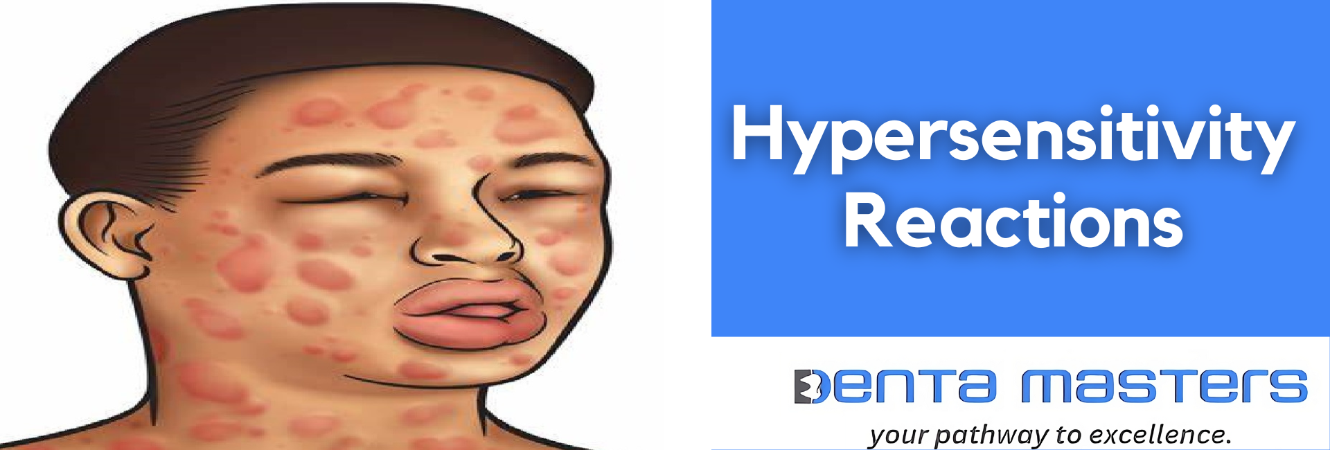 Understanding Hypersensitivity Reactions: What You Need to Know