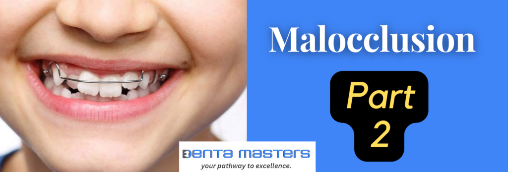 How to Overcome Malocclusion and achieve perfect smile Part – 2