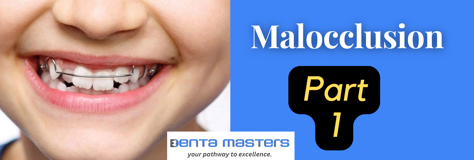 How to Overcome Malocclusion and Achieve a Perfect Smile Part-1