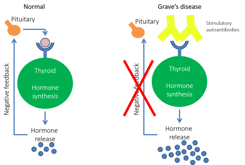 type II hypersensitivity reactions