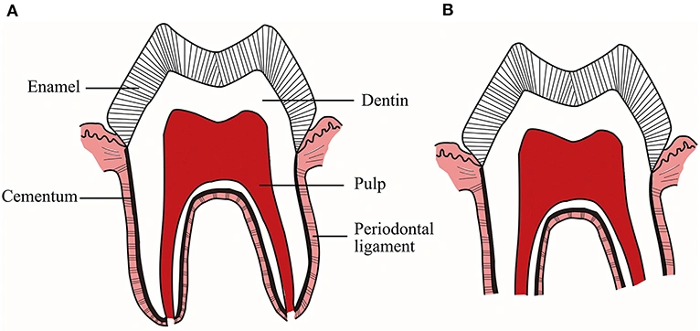 root resorption image