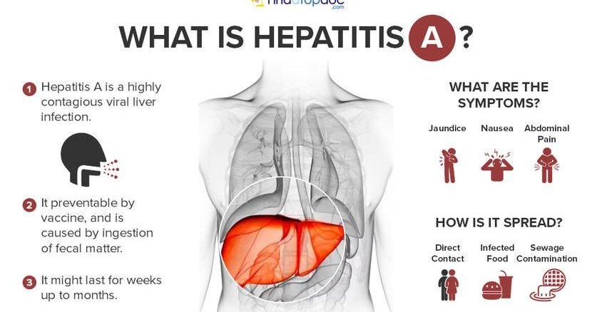 hepatitis A