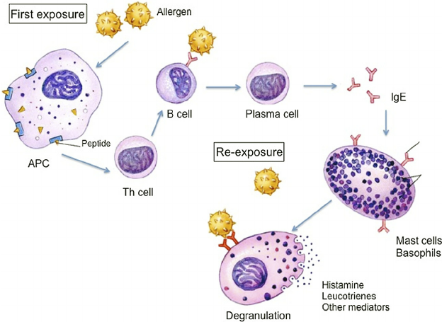 Type i reaction pathophysiology