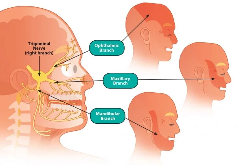 trigeminal nerve